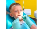 Лечение постоянных зубов у детей