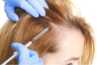 PRP терапия волос