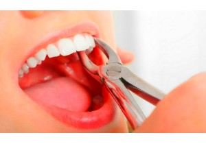 Удаление однокоренного зуба (средней сложности)