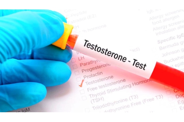 Анализ крови на тестостерон 