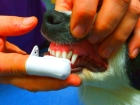 Удаление зубного налета, зубного камня: механически